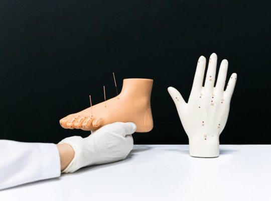 découvrez l'acupressure, une technique douce et efficace qui stimule des points spécifiques du corps pour soulager le stress, améliorer la circulation et favoriser le bien-être. apprenez les bienfaits de cette méthode ancestrale pour une santé équilibrée.