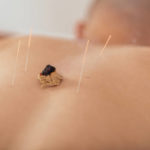 Peut-on consulter un expert en médecine chinoise à Bourgoin-Jallieu pour soulager des courbatures musculaires ?