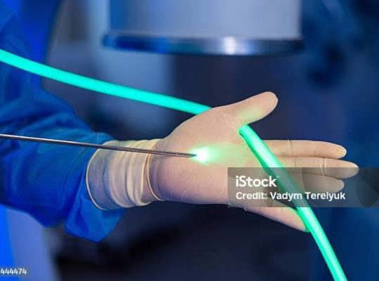 laser proctologie